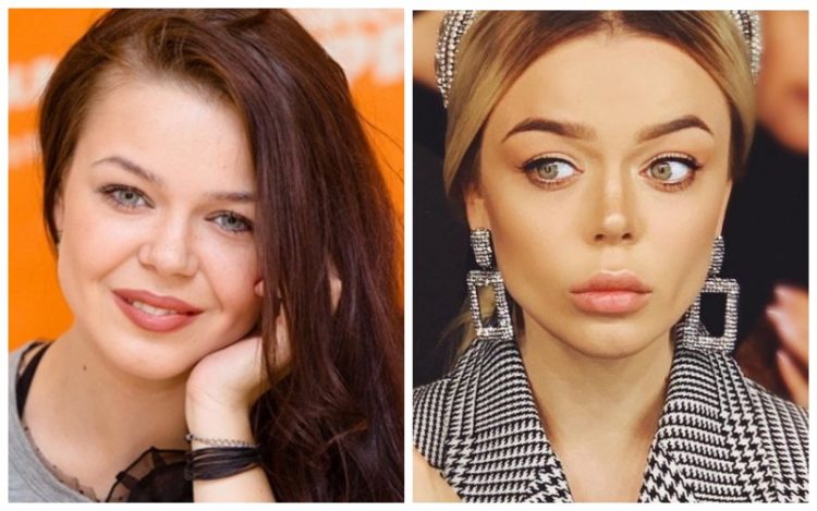 Знаменитості до та після пластики: 30 вражаючих фото